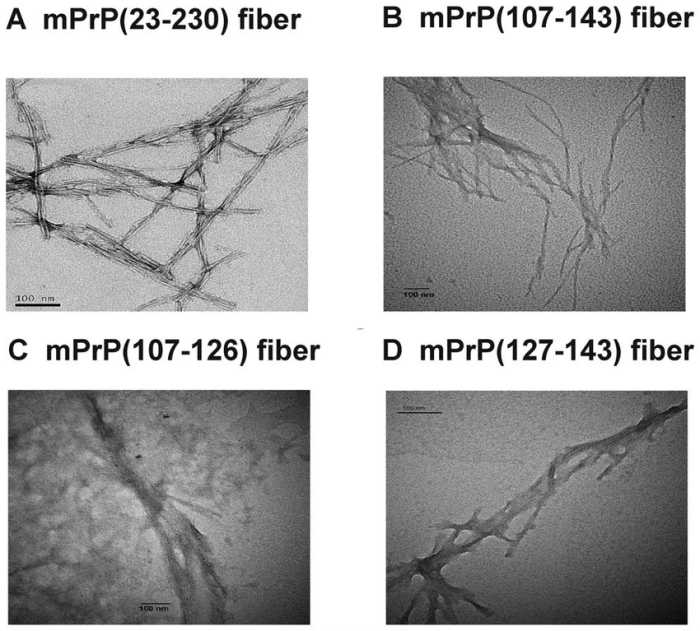 Choose the true statements about amyloid fibrils